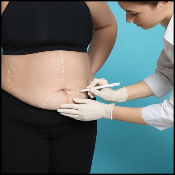 Bariatric Surgery - Healix Hospitals
