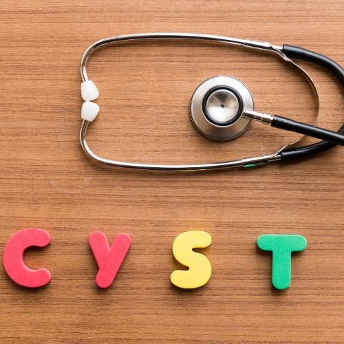 Head Cyst - Healix Hospitals