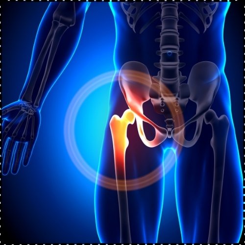 Hip Replacement Surgery - Healix Hospitals