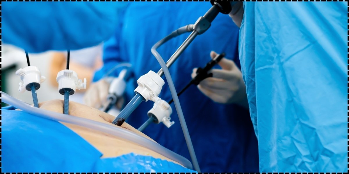 Minimally Invasive Gastrointestinal Surgery - Healix Hospitals